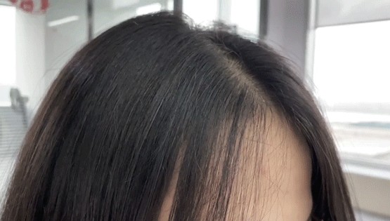 嘆頭部SPA！拒做人間油物解鎖防禿養(yǎng)發(fā)小妙招