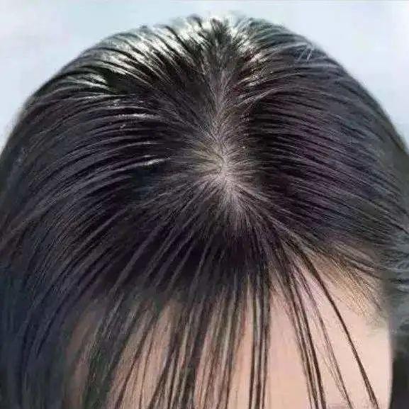嘆頭部SPA！拒做人間油物解鎖防禿養(yǎng)發(fā)小妙招