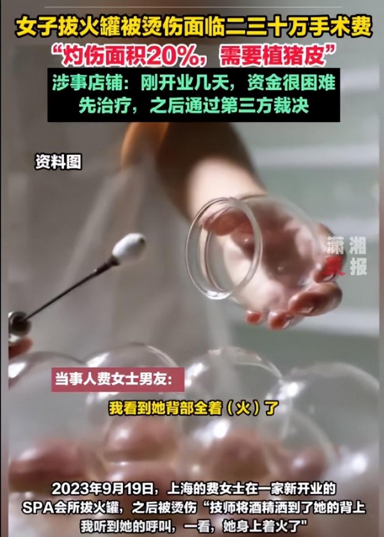 上海女子拔火罐遭燙傷SPA會所卻不肯賠償她的男友怎么說