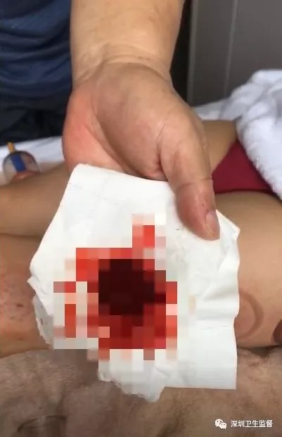 收費(fèi)10萬(wàn)!酒店內(nèi)給女子做按摩羅湖男子最后倒賠8萬(wàn)