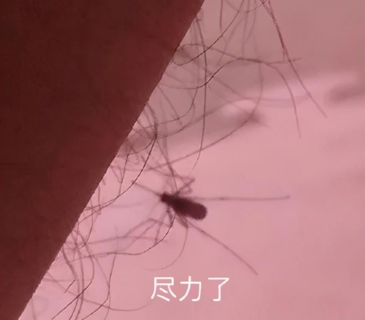 結(jié)腸SPA、冰點脫毛？光明生活美容院非法做這些項目被檢查