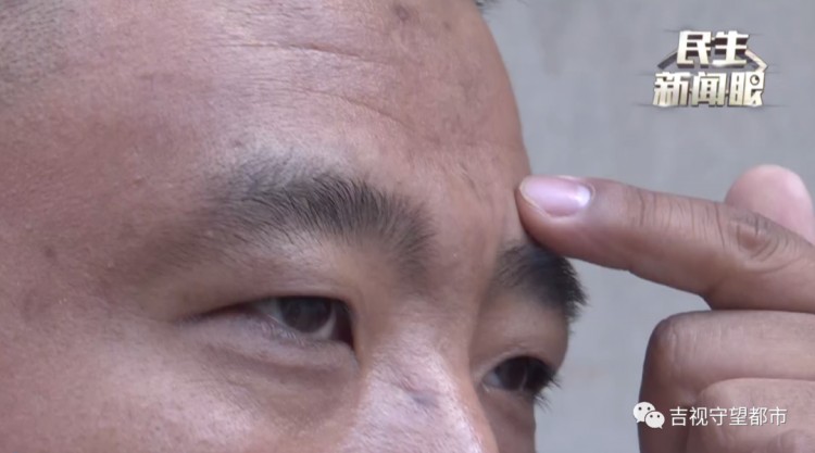 哥倆一心搞事業(yè)到長春幸福街纖手美容spa會所去川字紋結(jié)果卻變成了大包