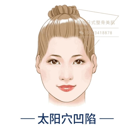 太原現！日式整骨小臉術！大V明星爆紅全靠它~