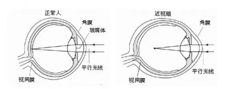 歐普康視——幫眼睛做個SPA毛利堪比茅臺
