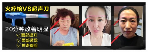 琦草集火療槍·細胞SPA量子熱療儀震撼全國發布
