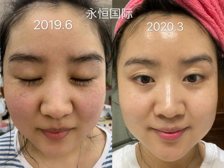 頭條！涂抹式微整護膚品進駐張家界！
