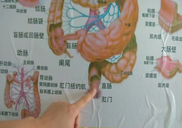 女子為養顏做腸道水療洗出腸穿孔進ICU醫生：只能治便秘