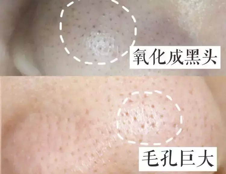 免費美膚SPA！韓國小姐姐都在做的高端護理就藏在高新