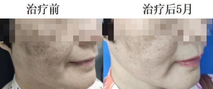 抗衰老一針年輕十歲福建專家告訴你真正的干細胞治療是怎樣的丨大醫(yī)生開講